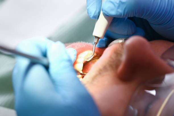 Best Emergency Dental Extractions in Thompsonville, PA