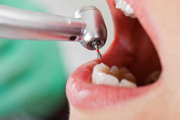 Best Emergency Dentist for Special Needs Patients in Thompsonville, PA